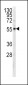 PKM2 Antibody (C-term C474)